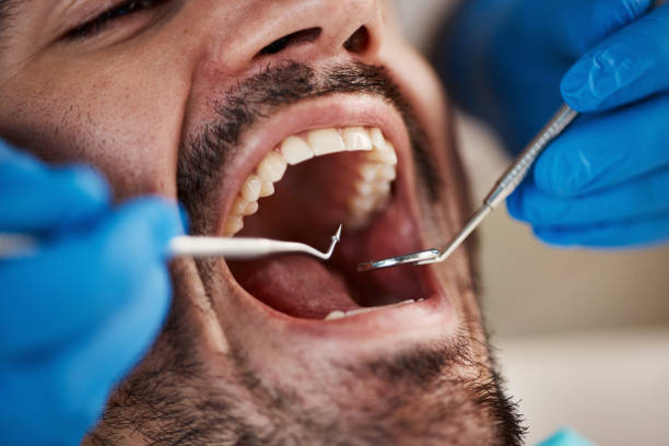 Best Mobile Emergency Dentist in Penitas, TX